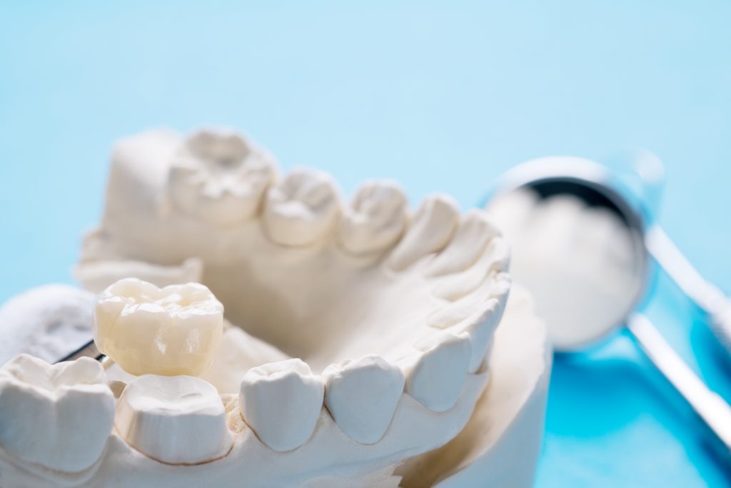 Dental crown